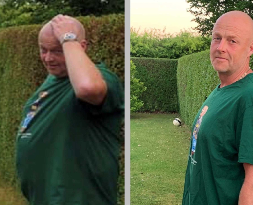 før og efter billed