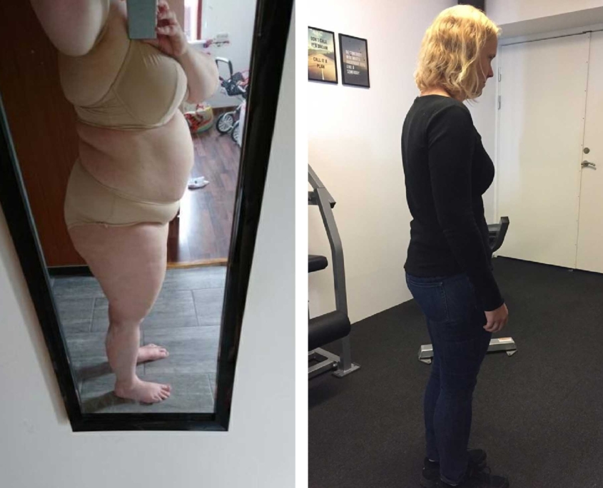 før og efter billed